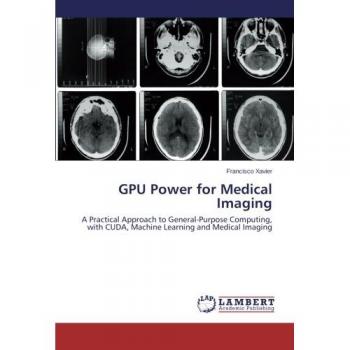 GPU Power for Medical Imaging: A Practical Approach to General-Purpose Computing, with CUDA, Machine Learning and Medical Imaging