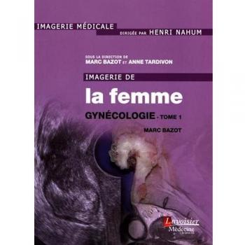 Imagerie de la femme : Gynécologie