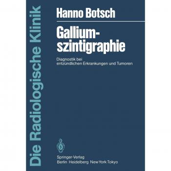 Galliumszintigraphie: Diagnostik bei Entzündlichen Erkrankungen und Tumoren