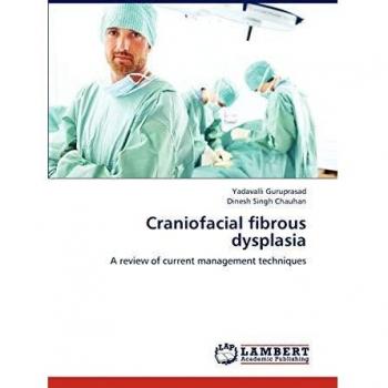 Craniofacial fibrous dysplasia