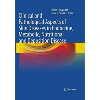 Clinical and Pathological Aspects of Skin Diseases in Endocrine, Metabolic, Nutritional and Deposition Disease