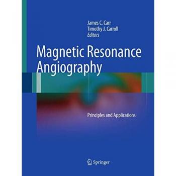 Magnetic Resonance Angiography