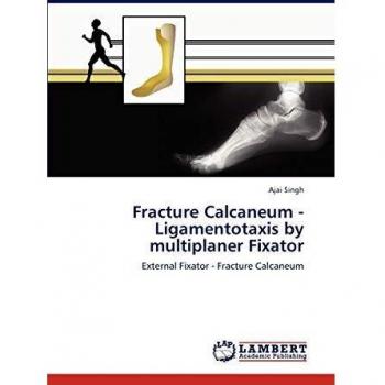 Fracture Calcaneum