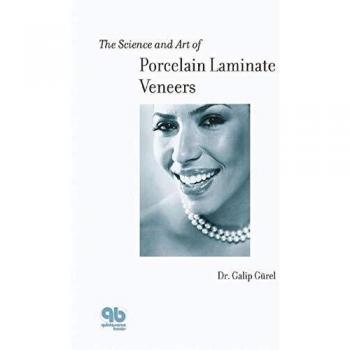 The Science and Art of Porcelain Laminate Veneers