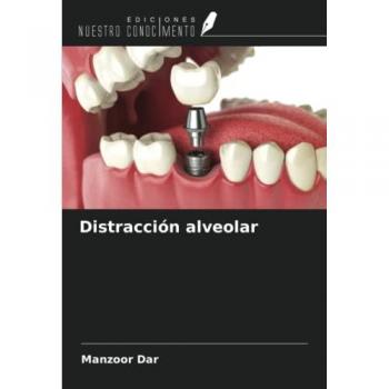 Dar, Manzoor: Distracción alveolar