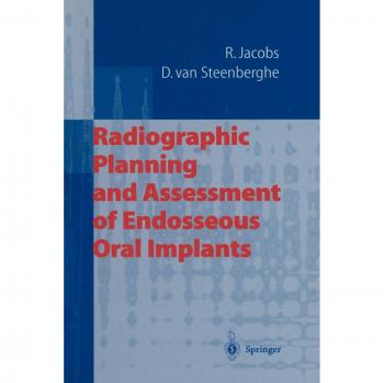 Radiographic Planning and Assessment of Endosseous Oral Implants