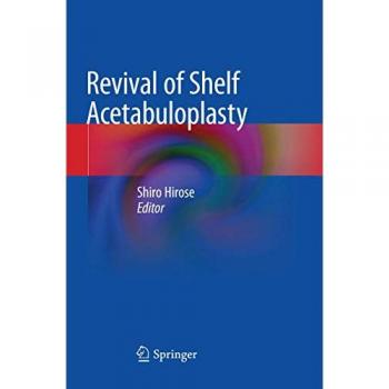 Revival of Shelf Acetabuloplasty, Fachbücher von Shiro Hirose