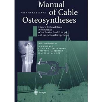 Manual of Cable Osteosyntheses: History, Technical Basis, Biomechanics of the Tension Band Principle, and Instructions for Operation