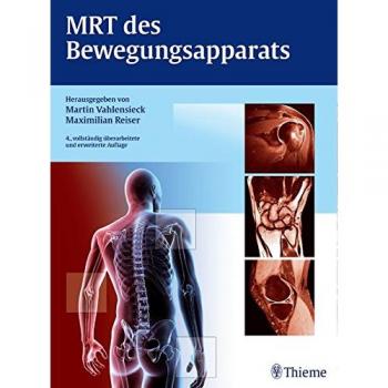 MRT des Bewegungsapparats