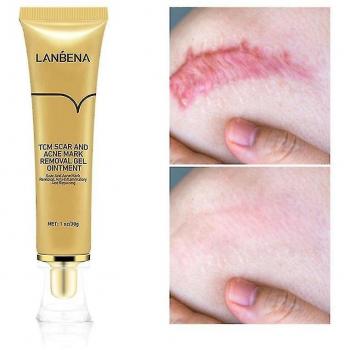Crema Facial Lanbena para Espinillas y Marcas de Acné 30g