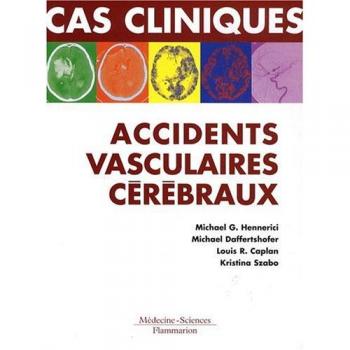 Cas cliniques : accidents vasculaires cérébraux : Formes cliniques habituelles et inhabituelles