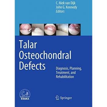 Talar Osteochondral Defects: Diagnosis, Planning, Treatment, and Rehabilitation