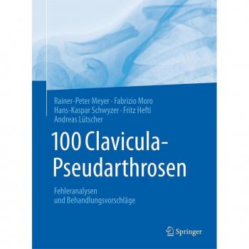 Vitalsource Technologies, Inc. 100 Clavicula-pseudarthrosen