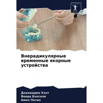 Внерадикулярные временные якорные устройства
