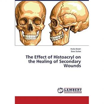 The Effect of Histoacryl on the Healing of Secondary Wounds
