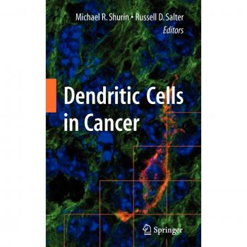 Dendritic Cells in Cancer