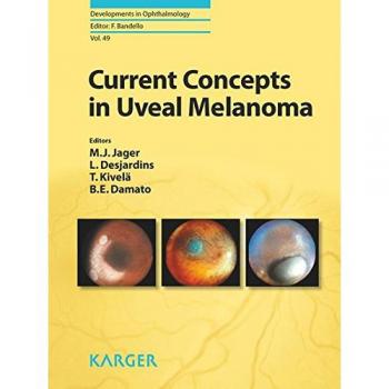 Current Concepts in Uveal Melanoma