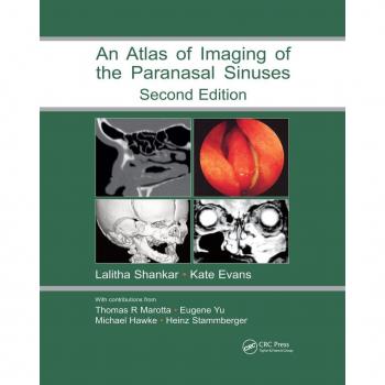Vitalsource Technologies, Inc. Atlas Of Imaging Of The Paranasal Sinuses, Second Edition