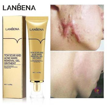 Crème Légère pour Cicatrices d’Acné