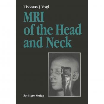 Vogl, Thomas J.: MRI of the Head and Neck