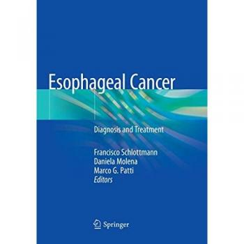 Esophageal Cancer: Diagnosis and Treatment