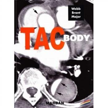 Tac body.