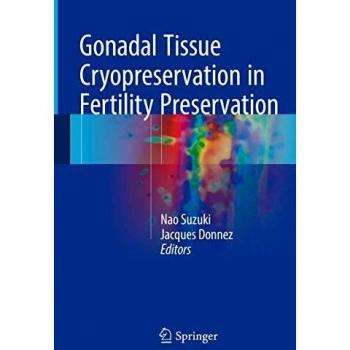Gonadal Tissue Cryopreservation in Fertility Preservation