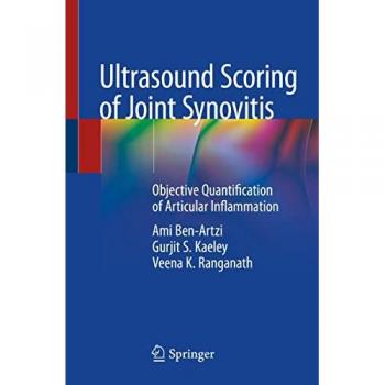 Ultrasound Scoring of Joint Synovitis: Objective Quantification of Articular Inflammation