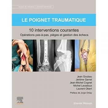 Jean Goubau Le Poignet Traumatique 10 Interventions Courantes: Manuel De Chirurgie Du Membre Supérieur