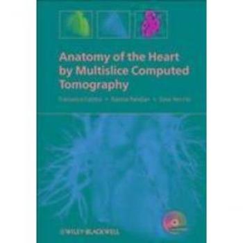 Anatomy of the Heart by Multislice Computed Tomography