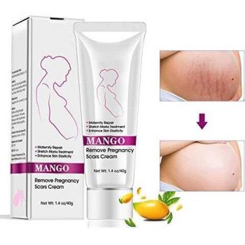 Postpartale Hautpflege – 40 g Narben & Stretch Marks Creme