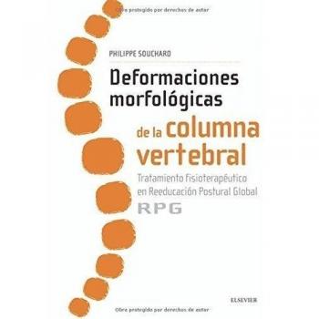Deformaciones morfológicas de la columna vertebral: Tratamiento fisioterapéutico en reeducación postural global RPG (Tapa blanda).