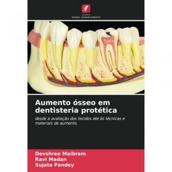 Maibram, Devshree: Aumento ósseo em dentisteria protética