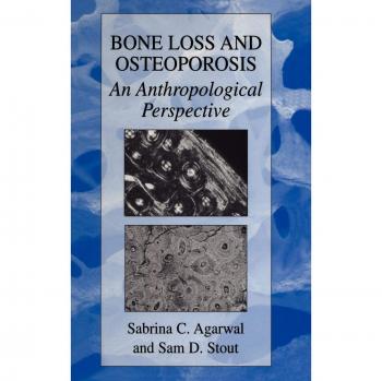 Bone Loss and Osteoporosis