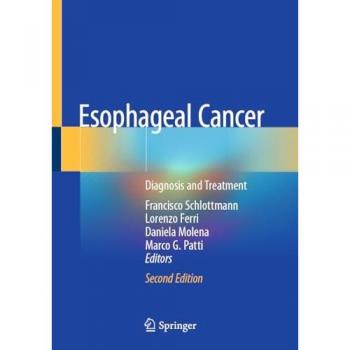 Esophageal Cancer