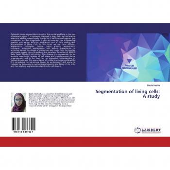 Segmentation of living cells: A study
