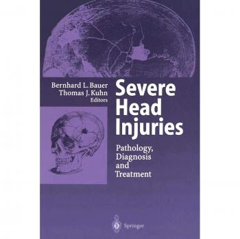 Severe Head Injuries