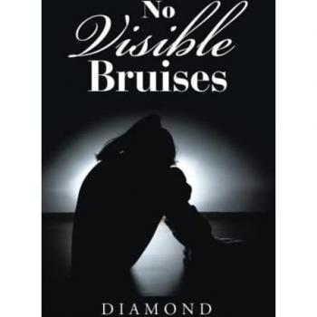 Diamond: No Visible Bruises