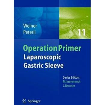 Laparoscopic Gastric Sleeve