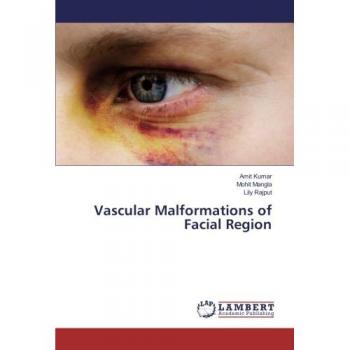 Kumar, Amit: Vascular Malformations of Facial Region