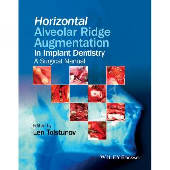 Vitalsource Technologies, Inc. Horizontal Alveolar Ridge Augmentation In Implant Dentistry