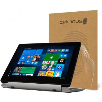 Celicious ProtectShield – Shatterproof Cover for Akoya E1240T