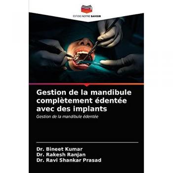 Gestion de la mandibule complètement édentée avec des implants: Gestion de la mandibule édentée