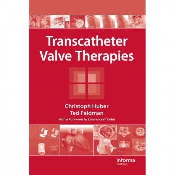 Vitalsource Technologies, Inc. Transcatheter Valve Therapies
