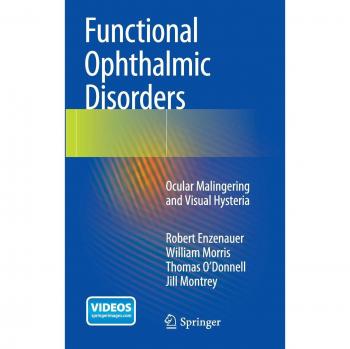 Functional Ophthalmic Disorders: Ocular Malingering and Visual Hysteria