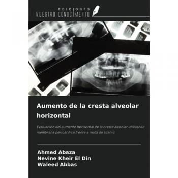 Abaza, Ahmed: Aumento de la cresta alveolar horizontal