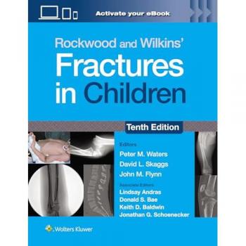 Rockwood and Wilkins' Fractures in Children: Print + eBook with Multimedia