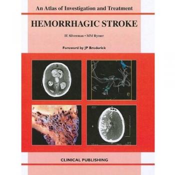 Hemorrhagic Stroke