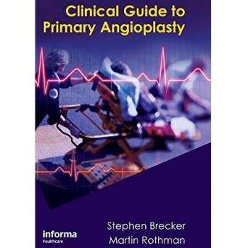 Essential Concepts of Primary Angioplasty