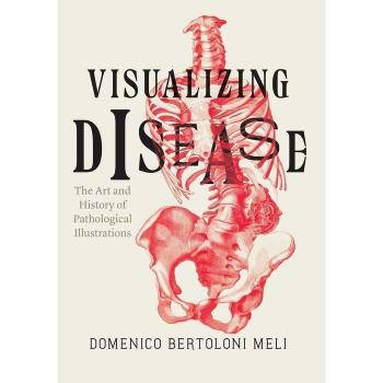 Visualizing Disease by Domenico Bertoloni Meli Hardcover Book